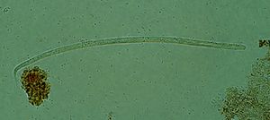 온코세르카증의 원인이 되는 회선사상충