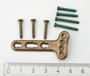 손목 골절을 치료하는 데 사용되는 의료용 나사 및 플레이트. 눈금은 센티미터 단위이다.