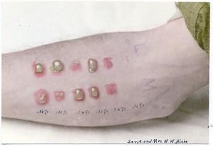 루이사이트(상단)와 농도가 0.01%에서 0.06%인 겨자 가스 테스트