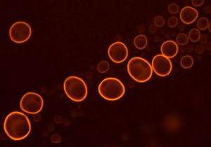 형광 염료 아크리딘 오렌지로 염색된 포스파티딜콜린 리포솜의 현미경 사진. 형광 현미경 (1250배율) 방법.