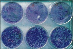 MRC-5 세포의 단층에서 수두 대상 포진 바이러스에 의해 생성된 플라크. 바이러스가 증식했을 때 각 웰에는 항바이러스제 아시클로버가 다른 양으로 들어 있었다. 플라크(세포층에서 바이러스에 의해 형성된 구멍)를 세어 바이러스에 대한 아시클로버의 효능을 계산했다.