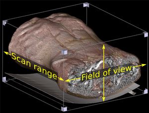 컴퓨터 단층 촬영술(CT, 복부 CT 사진)에서 복셀은 시야(FOV)에 '스캔 범위'를 곱하여 생성된다.