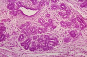 에스트로스 주기 동안 증식하는 인간 젖샘의 광학 현미경 사진. 싹이 트는 젖샘 조직이 왼쪽 상단에 보임 (헤마톡실린-에오신 염색)