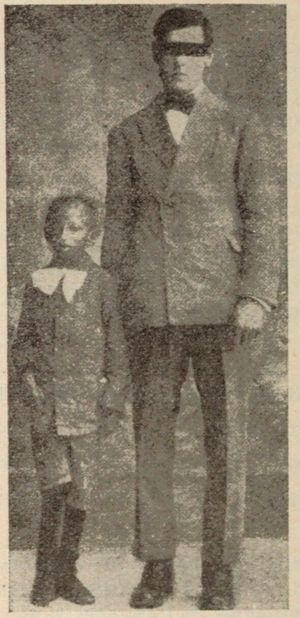 19세 프로제리아 환자(왼쪽)와 프로제리아가 없는 같은 나이의 남성(오른쪽)