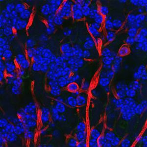 붉은색의 수초 기본 단백질에 대한 항체로 염색하고 파란색의 DNA로 염색한 쥐 소뇌의 희소돌기아교세포. 두 개의 희소돌기아교세포 세포체가 명확하게 보이며, 여러 개의 수초화된 축삭도 보인다. 이들은 속이 빈 튜브이므로 이 공초점 이미지에서 "트램라인"처럼 보인다. 대부분의 DNA는 작은 내부 뉴런인 소뇌 과립 세포의 핵에 있다.