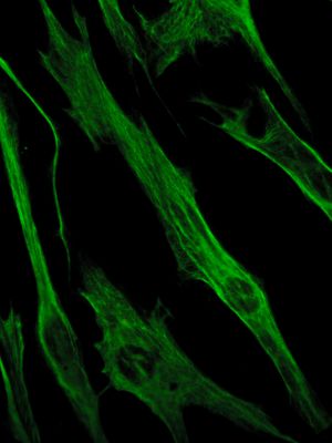 비멘틴 섬유가 있는 섬유아세포