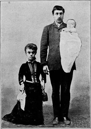 연골무형성증을 앓는 어머니와 자녀, 정상적인 아버지, 유전 양상