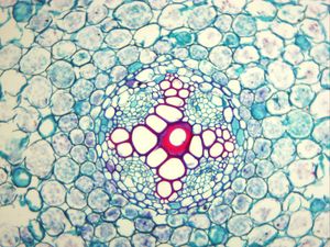 붉은색/주황색으로 염색된 물관부 도관 (400배 배율)