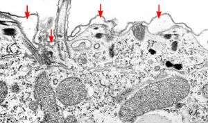 섬모충류 Paramecium putrinum의 표면의 얇은 단면을 촬영한 투과 전자 현미경 사진으로, 세포 표면 아래의 소포(빨간색 화살표)를 보여준다.
