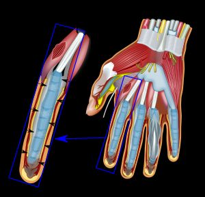 오른손 검지의 굴곡건의 건초를 덮고 있는 환상(A1-A5) 및 십자형(C0-C3) 인대