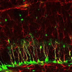 녹색으로 보이는 신경 줄기 세포
