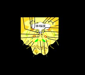 다리 아랫부분의 가로 단면. 갓돌림신경핵은 얼굴신경의 섬유 다발에 둘러싸인 위치에 있다.