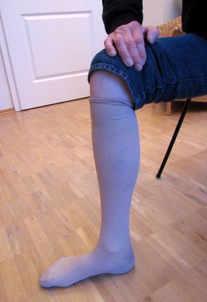 압박 스타킹의 예시