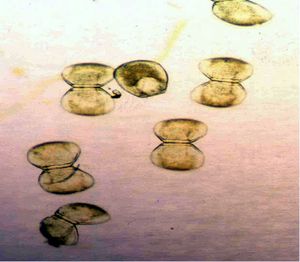 히긴스조개(Lampsilis higginsii)의 글로키디아 유생