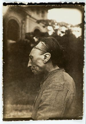 두개골을 의도적으로 길게 한 것, "툴루즈 변형", 프랑스