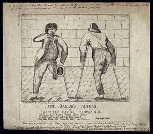 1783년 부상당한 선원들의 에칭