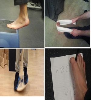 발목 염좌 재활 운동