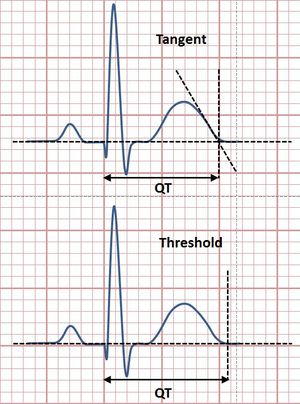 QT 간격 측정의 접선 및 임계값 방법 그림