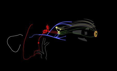 동공의 교감 및 부교감 신경 지배와 호너 증후군에서의 병변 부위를 보여주는 도식