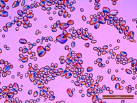 편광 현미경으로 본 감자 녹말, 배율 100배