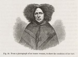 그림 19: "정신 이상 여성의 사진, 머리카락 상태를 보여주기 위해."