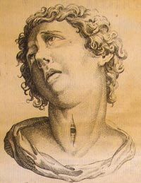 20세기 이전의 기관절개술