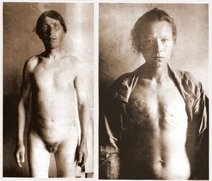 거세된 스코프치 남성(왼쪽)과 가슴을 절제한 스코프치 여성(오른쪽)