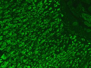 위 벽세포 항체에 대한 면역형광 염색 패턴(위 단면)