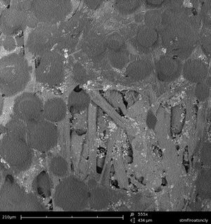 주사 전자 현미경으로 555배 확대한 포스트잇 접착면