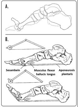 발가락을 등쪽으로 굽혔을 때 아치 높이에 미치는 영향(A). 윈드라스 기전(B).
