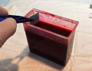 현미경 슬라이드 염색용 에오신 Y 용액