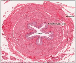 수뇨관의 현미경 횡단면. 상피(보라색 세포)가 강 옆에 있으며, 상피를 둘러싼 많은 근육 섬유와 바깥쪽의 모험막이 보인다.