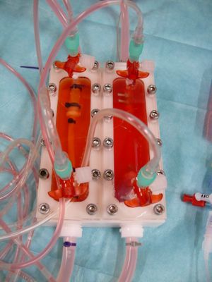 혈관 이식편 배양을 위한 생물 반응기