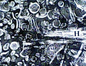 음성 염색의 예시