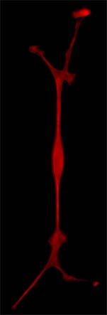 배양 중인 슈반세포