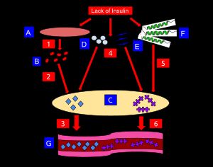 케톤산증의 발생 과정 모식도. A: 근섬유, B: 아미노산, C: 간, E: 지방산 F: 글루카곤, G: 혈관