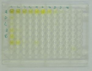 효소 결합 면역 흡착 검사 플레이트