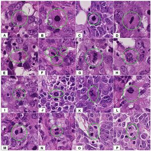 유방암에서의 체세포 분열 모습