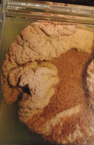 밍크고래의 선위에 기생하는 아니사키스 (Anisakis simplex)。국립과학박물관 전시.