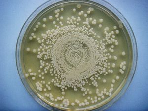 72시간 배양 후 뮬러-힌튼 한천 배지 위의 Burkholderia pseudomallei 집락