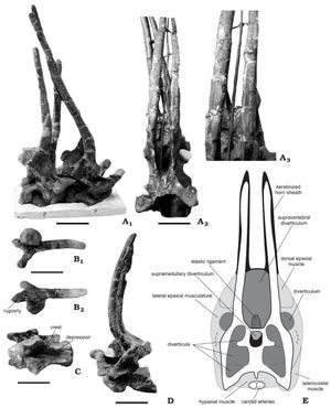 전형 표본의 목 척추, 연조직의 단면 재구성 포함