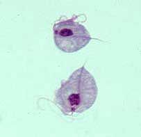 황갈색쌀쥐에서 발견되는 것과 유사한 Trichomonas sp.의 예