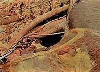 홀정맥의 구조와 위치