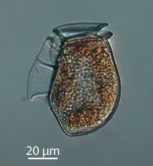 편모충류(The dinoflagellate Dinophysis acuta)