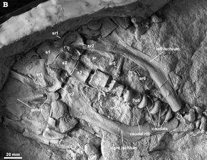 골반 부위의 모형
