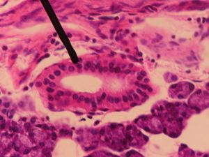 귀밑샘 내 줄무늬관