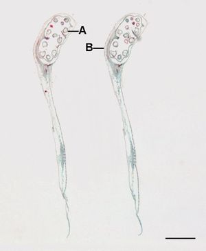 물부추 거대포자낭