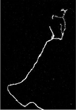 성장 원뿔이 보이는 생후 9일 된 쥐의 축삭