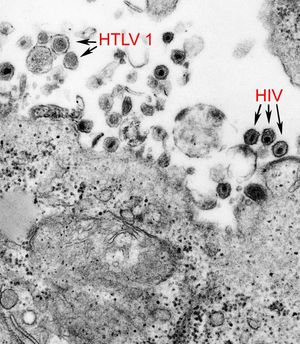 인간 T-림프친화 바이러스 1형(HTLV-1)과 인간 면역결핍 바이러스(HIV).