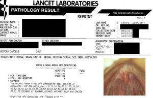 실험실의 HPV 유전자형에 대한 샘플 DNA 테스트 보고서